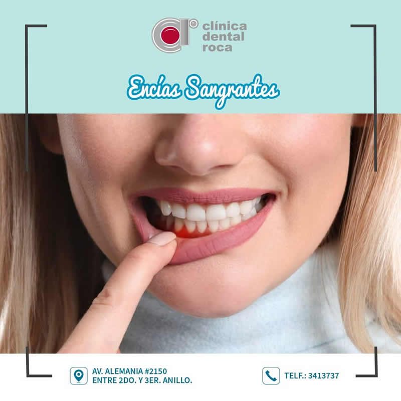 periodoncia